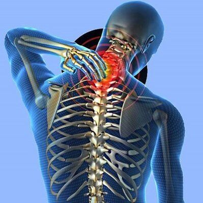 պարանոցի ցավը արգանդի վզիկի օստեոխոնդրոզով