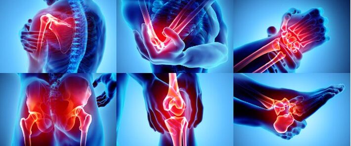 Բորբոքված հոդեր